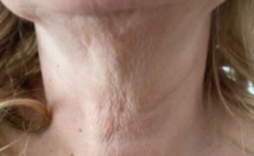 Before - Claire Hughes Dental