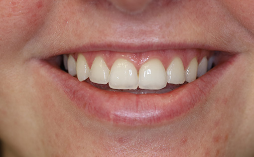 After - Claire Hughes Dental