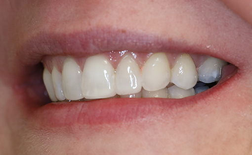 After - Claire Hughes Dental