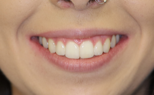 After - Claire Hughes Dental