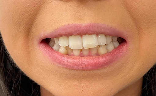 Before - Claire Hughes Dental