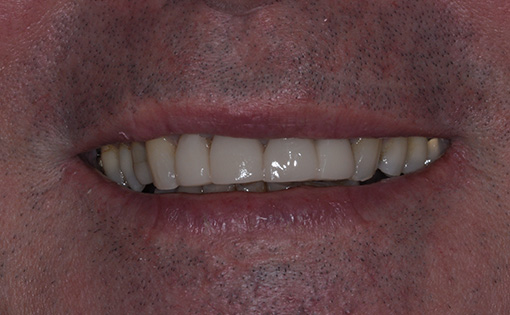 After - Claire Hughes Dental