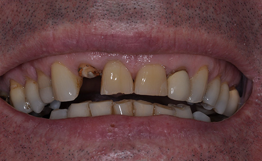 Before - Claire Hughes Dental