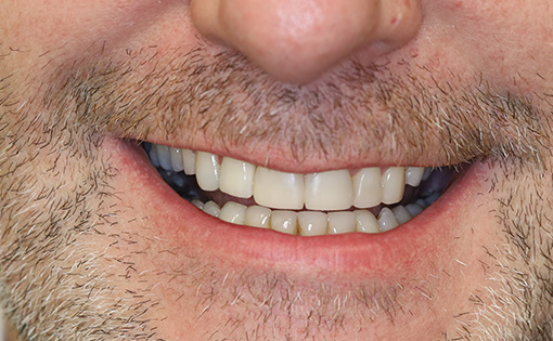 After - Claire Hughes Dental