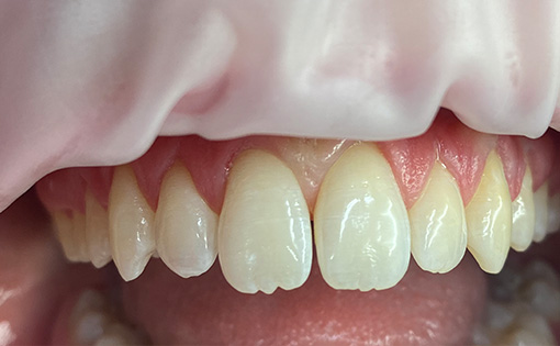 After - Claire Hughes Dental