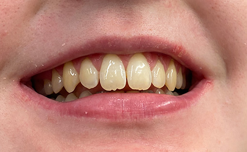 Before - Claire Hughes Dental