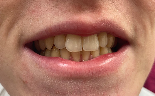 Before - Claire Hughes Dental