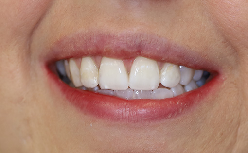 After - Claire Hughes Dental
