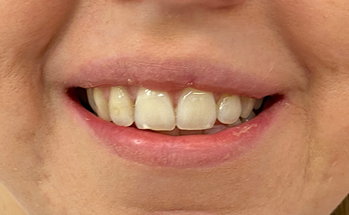 Before - Claire Hughes Dental