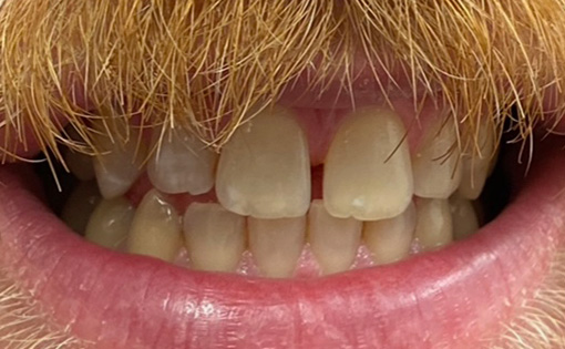 Before - Claire Hughes Dental