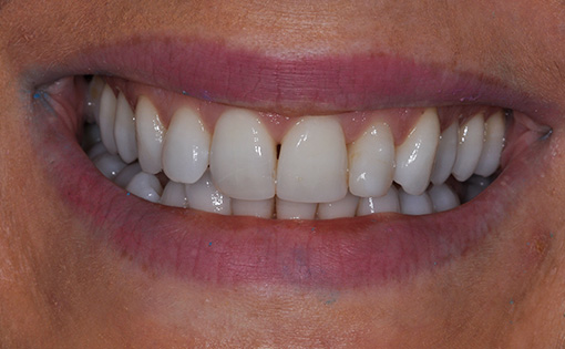 Before - Claire Hughes Dental