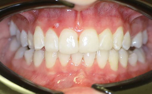 After - Claire Hughes Dental