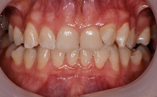 Before - Claire Hughes Dental