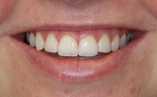 After - Claire Hughes Dental