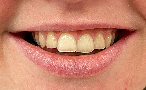 Before - Claire Hughes Dental